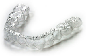 clear aligners invisalign